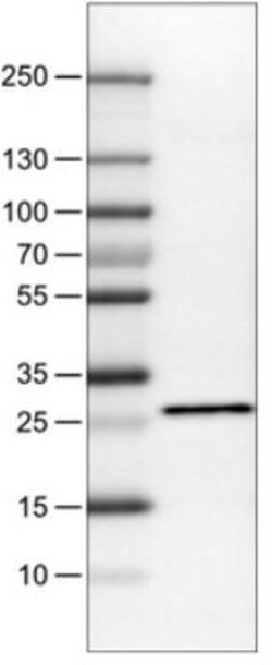 SDHB Antibody (CL0346), Novus Biologicals 25 &mu;L, Unlabeled:Antibodies,