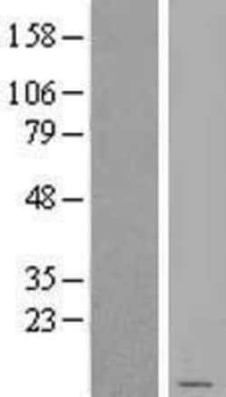 Novus Biologicals&trade;&nbsp;SDHD Overexpression Lysate