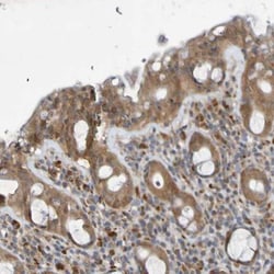 SDK1 Antibody, Novus Biologicals 0.1mL; Unlabeled:Antibodies, Polyclonal