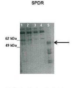SDPR Antibody, Novus Biologicals 20&mu;L; Unlabeled:Antibodies, Polyclonal