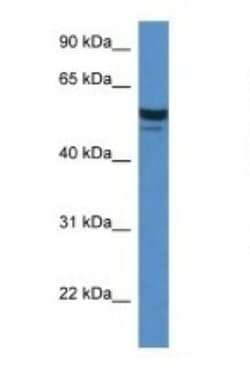 SDPR Antibody, Novus Biologicals 20&mu;L; Unlabeled:Antibodies, Polyclonal