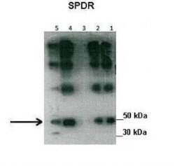 SDPR Antibody, Novus Biologicals 20&mu;L; Unlabeled:Antibodies, Polyclonal