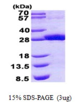Novus Biologicals Recombinant Human SDR16C5 His Protein 0.1 mg | Buy Online | Novus Biologicals&trade; | Fisher Scientific