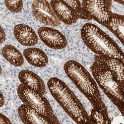 SDR16C5 Antibody, Novus Biologicals 0.1mL; Unlabeled:Antibodies, Polyclonal