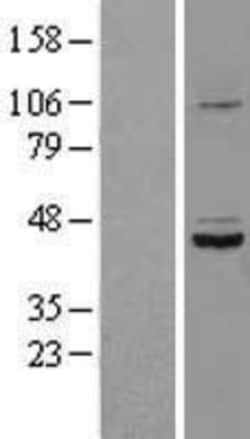 Novus Biologicals&trade;&nbsp;SDS3 Overexpression Lysate