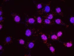 SDS3 Antibody, Novus Biologicals 0.1mg; Unlabeled:Antibodies, Polyclonal