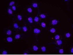 SDS3 Antibody, Novus Biologicals 0.1mg; Unlabeled:Antibodies, Polyclonal