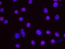 SDS3 Antibody, Novus Biologicals 0.1mg; Unlabeled:Antibodies, Polyclonal