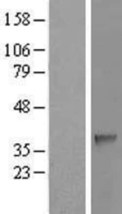 Novus Biologicals&trade;&nbsp;SDSL Overexpression Lysate