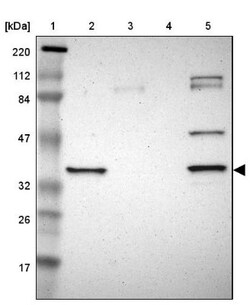SDSL Antibody, Novus Biologicals 0.1mL; Unlabeled:Antibodies, Polyclonal