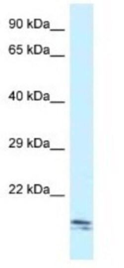 SEC11C Antibody, Novus Biologicals:Antibodies:Primary Antibodies