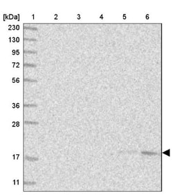 SEC11C Antibody, Novus Biologicals 25 &mu;L; Unlabeled:Antibodies, Polyclonal