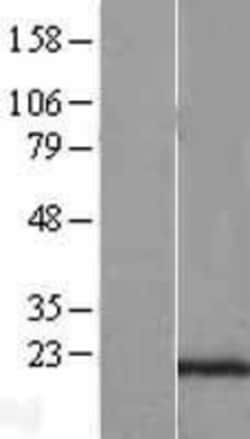 Novus Biologicals&trade;&nbsp;SEC11C Overexpression Lysate