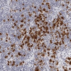 SEC11C Antibody, Novus Biologicals 25 &mu;L; Unlabeled:Antibodies, Polyclonal