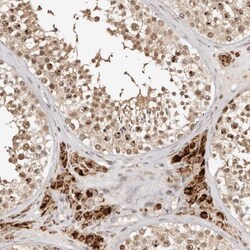 SEC14L1 Antibody, Novus Biologicals 0.1mL; Unlabeled:Antibodies, Polyclonal