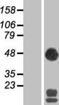 Novus Biologicals&trade;&nbsp;SEC14L2 Overexpression Lysate