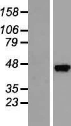 Novus Biologicals™ SEC14L3 Overexpression Lysate