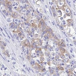 SEC14L3 Antibody, Novus Biologicals 25 &mu;L, Unlabeled:Antibodies, Polyclonal