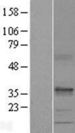 Novus Biologicals&trade;&nbsp;SEC22C Overexpression Lysate