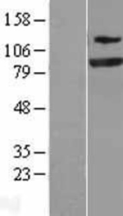 Novus Biologicals™ SEC23A Overexpression Lysate