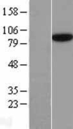 Novus Biologicals&trade;&nbsp;SEC23B Overexpression Lysate