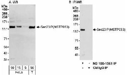 SEC23IP Antibody, Novus Biologicals 0.1mL; Unlabeled:Antibodies, Polyclonal
