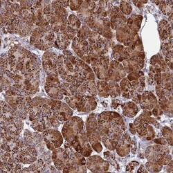 SEC24D Antibody, Novus Biologicals 25ul | Buy Online | Novus Biologicals | Fisher Scientific