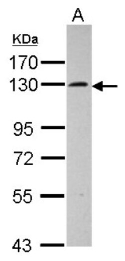 SEC24D Antibody, Novus Biologicals 0.1mL; Unlabeled:Antibodies, Polyclonal