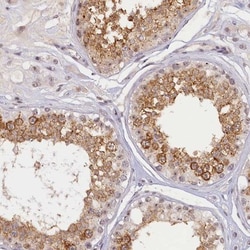 SEC31B Antibody, Novus Biologicals 0.1mL; Unlabeled:Antibodies, Polyclonal