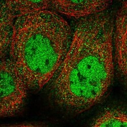 SEC3 Antibody, Novus Biologicals 0.1mL; Unlabeled:Antibodies, Polyclonal