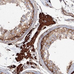 SEC3 Antibody, Novus Biologicals 0.1mL; Unlabeled:Antibodies, Polyclonal