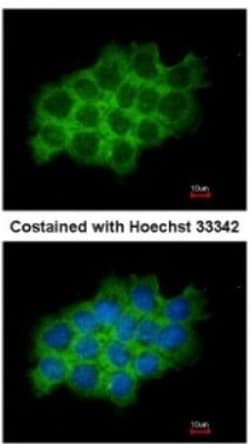 SEC61A Antibody, Novus Biologicals 0.1mg; Unlabeled:Antibodies, Polyclonal