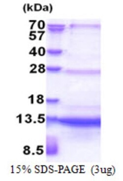 Novus Biologicals&trade;&nbsp;Recombinant Human SEC61B His Protein