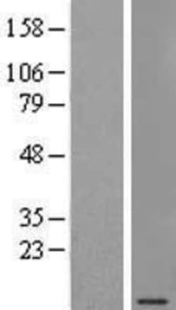 Novus Biologicals™ SEC61G Overexpression Lysate