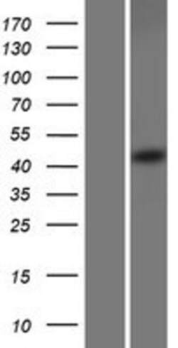 Novus Biologicals&trade;&nbsp;SEC62 Overexpression Lysate