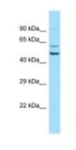 SEC62 Antibody, Novus Biologicals 100&mu;L; Unlabeled:Antibodies, Polyclonal