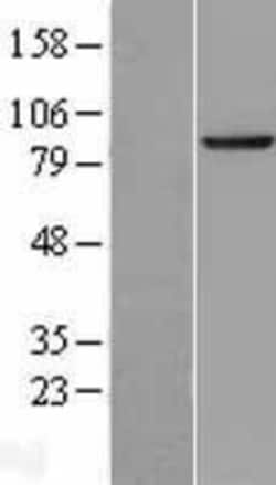 Novus Biologicals&trade;&nbsp;SEC63 Overexpression Lysate