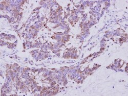 Sec8 Antibody, Novus Biologicals 0.1mL; Unlabeled:Antibodies, Polyclonal