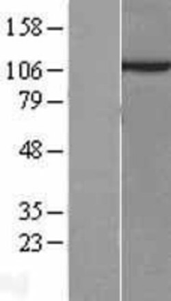 Novus Biologicals™ Sec8 Overexpression Lysate