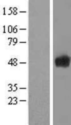 Novus Biologicals&trade;&nbsp;Secernin-1 Overexpression Lysate