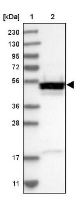 Secernin-1 Antibody, Novus Biologicals 0.1mL; Unlabeled:Antibodies, Polyclonal