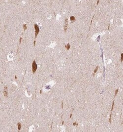 Secretogranin 3 Antibody, Novus Biologicals:Antibodies:Primary Antibodies