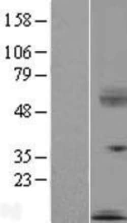 Novus Biologicals&trade;&nbsp;SECTM1 Overexpression Lysate