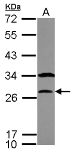 PTTG1 Antibody, Novus Biologicals 0.1mL; Unlabeled:Antibodies, Polyclonal