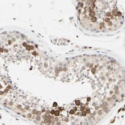 PTTG1 Antibody, Novus Biologicals 25 &mu;L; Unlabeled:Antibodies, Polyclonal