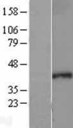 Novus Biologicals&trade;&nbsp;SEH1L Overexpression Lysate