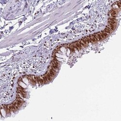 SELH Antibody, Novus Biologicals:Antibodies:Primary Antibodies