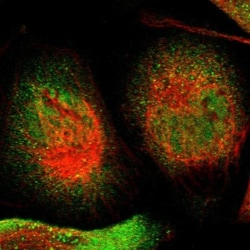 SELK Antibody, Novus Biologicals 0.1mL; Unlabeled:Antibodies, Polyclonal