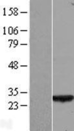 Novus Biologicals&trade;&nbsp;SELRC1 Overexpression Lysate