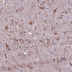 SELT Antibody, Novus Biologicals 0.1 mL | Buy Online | Novus Biologicals | Fisher Scientific